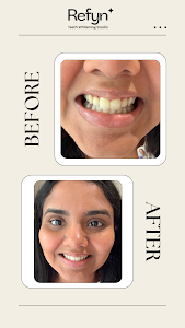 Refyn teeth whitening studio place picture